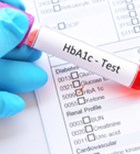 הדבקה ובדיקות איידס: אתם שואלים, הדוקטורס עונים-תמונה